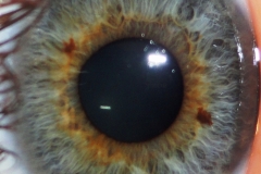 Human Eye Iris Close-up